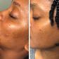 Masque Anti-tâches au curcuma
