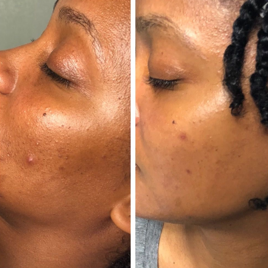 Masque Anti-tâches au curcuma + 1 pinceau applicateur OFFERT