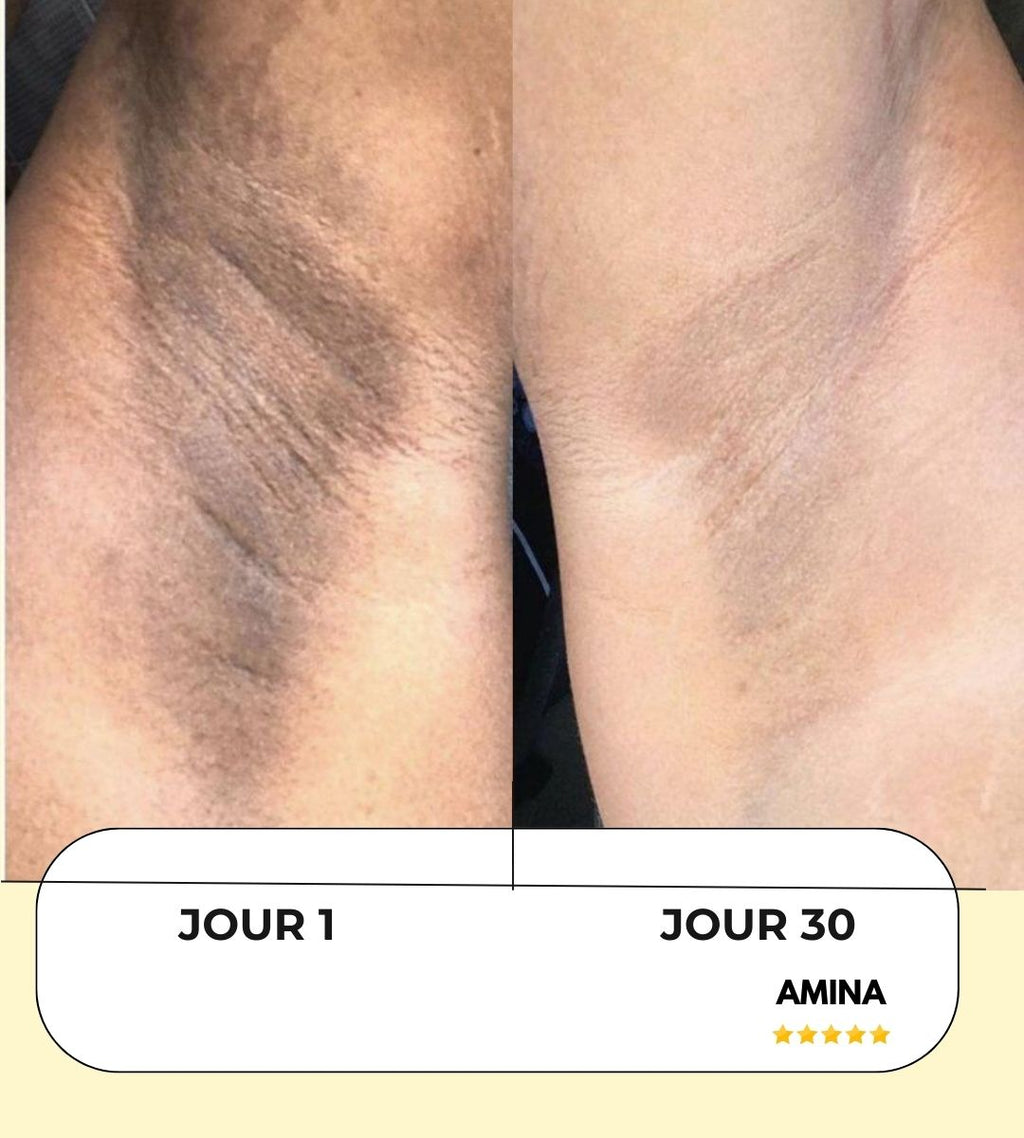 Masque Anti-tâches au curcuma + 1 pinceau applicateur OFFERT