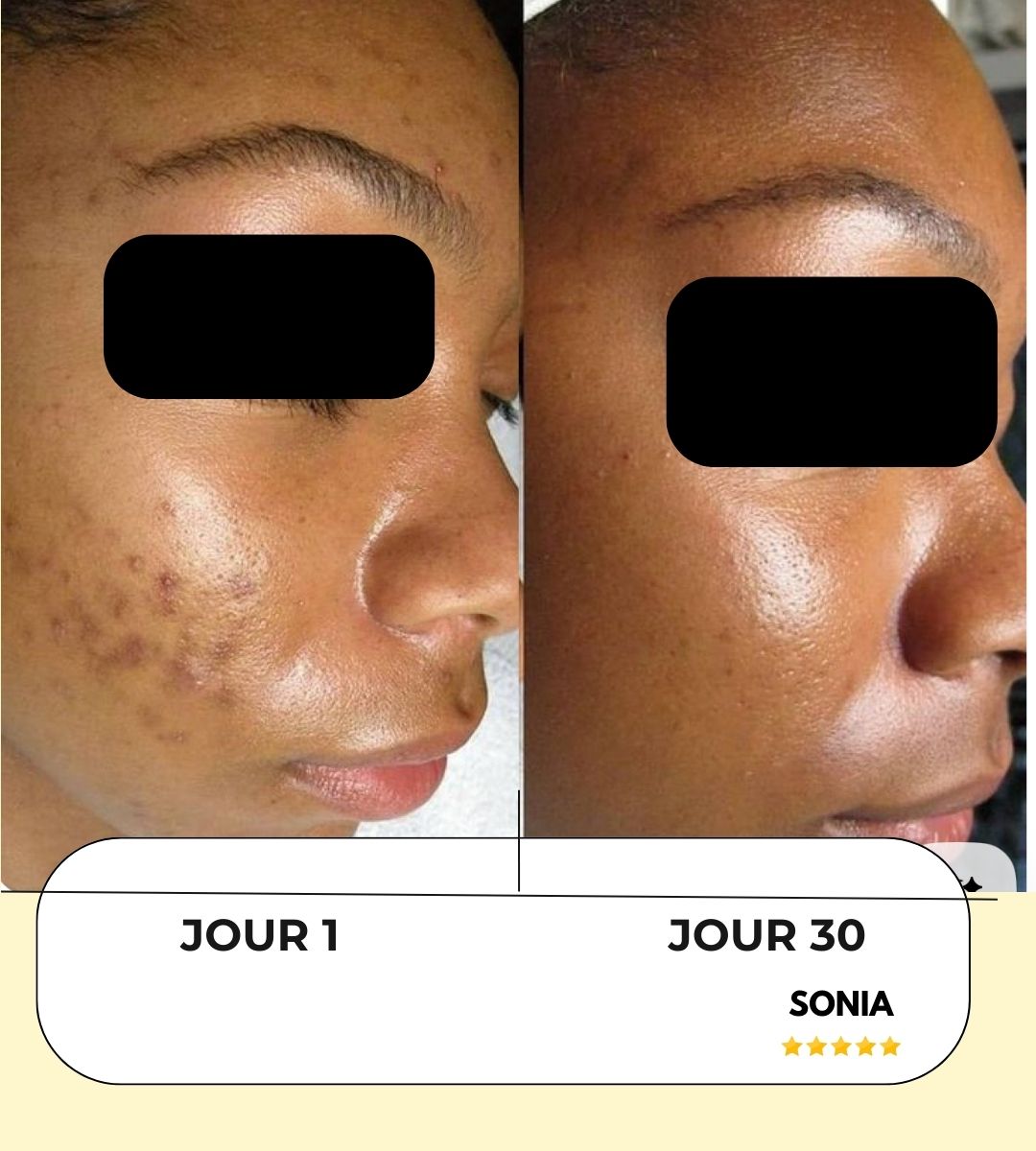 Masque Anti-tâches au curcuma + 1 pinceau applicateur OFFERT