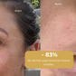 Masque Anti-tâches au curcuma