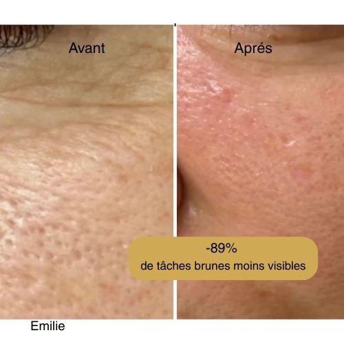 Masque Anti-tâches au curcuma + 1 pinceau applicateur OFFERT