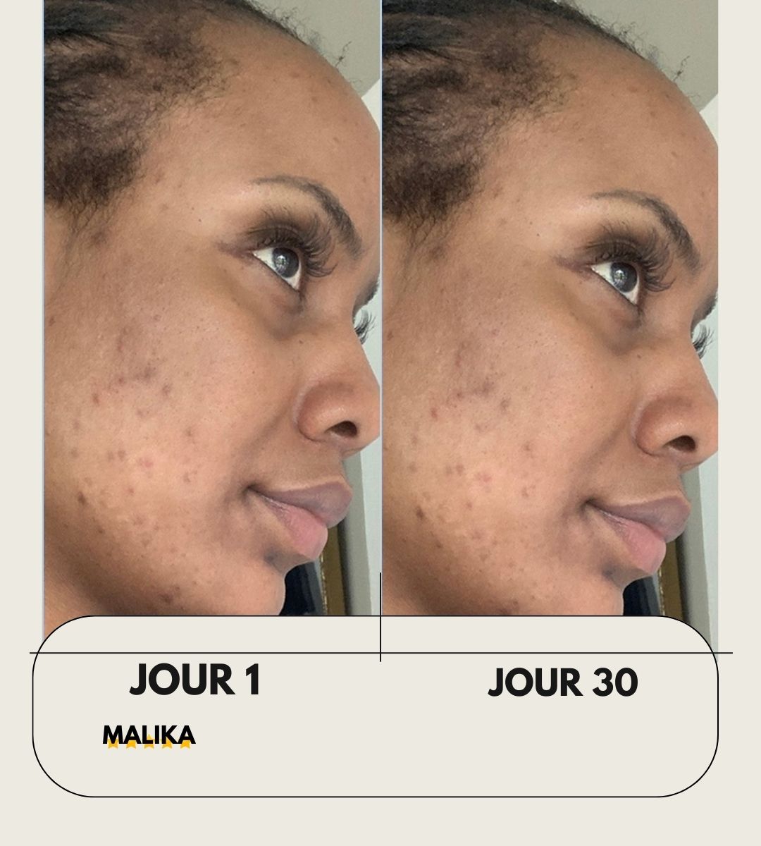 Masque Anti-tâches au curcuma + 1 pinceau applicateur OFFERT